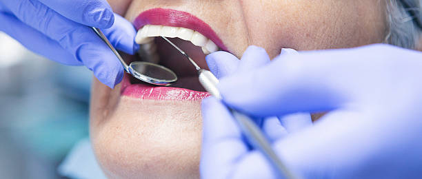 Best Emergency Dental Care for Broken or Chipped Teeth in Lindon, UT